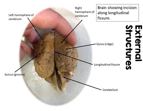 Sheep Brain Diagram Labeled