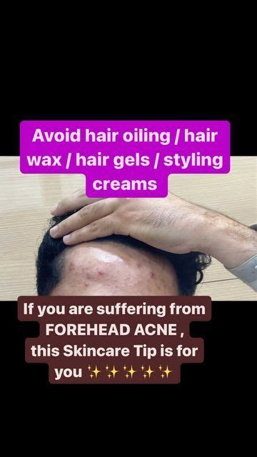 Dr Ashima Goel Dermatologist On Instagram Skincare Tip For