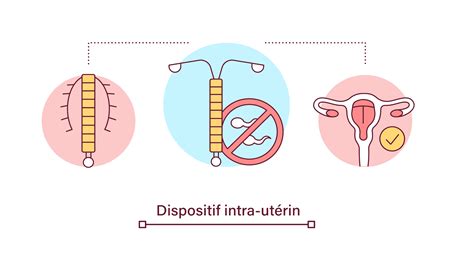 Diu Au Cuivre Ou Diu Hormonal Lequel Choisir Information