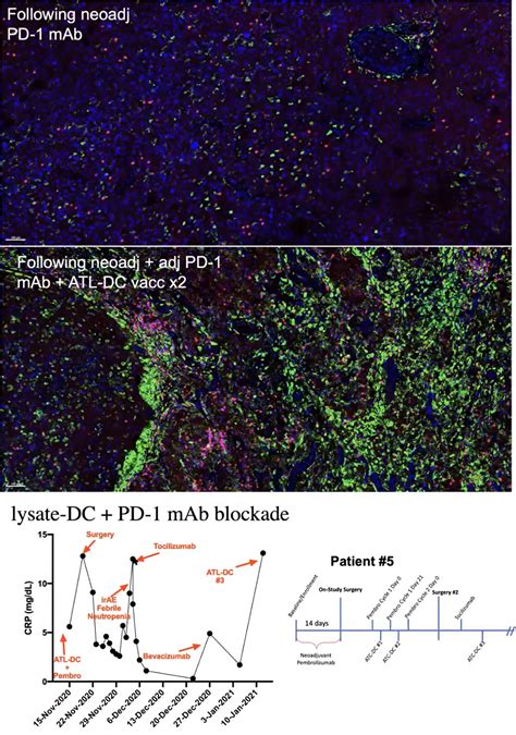 Why monitoring the ihub nwbo boards is essential for biotech fans