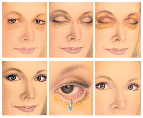 Eyelid Surgery Blepharoplasty Jacksonville Ponte Vedra Fl