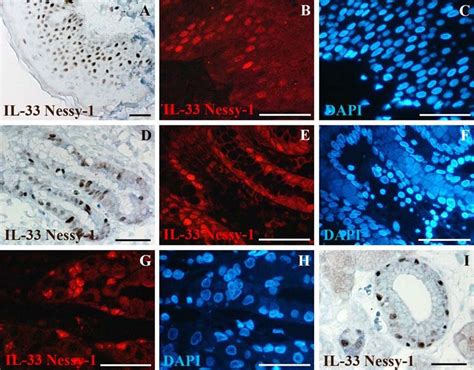 Il 33 Is Constitutively Expressed In The Nucleus Of Epithelial Cells In