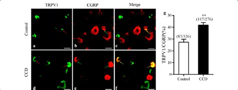 Immunofluorometric Analysis Of TRPV1 And CGRP Expressions In DRG