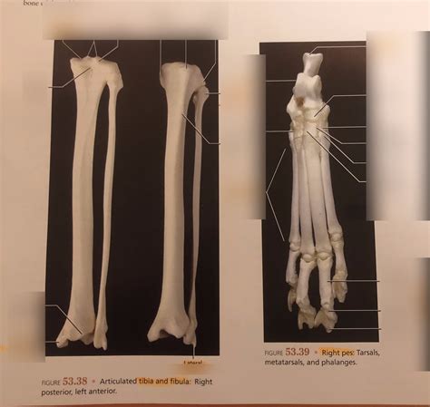 Cat Tibia And Fibula Diagram Quizlet