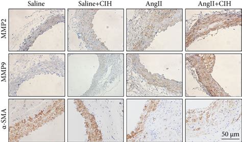 Cih Upregulates Aaa Related Expression Of Mmp Protein In Vivo An