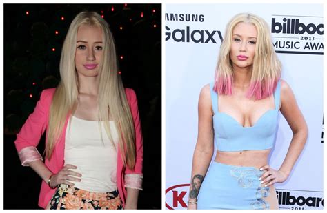 See What Iggy Azalea Looked Like Before All That Plastic Surgery