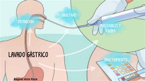 Lavado Gastrico By Raquel Bv On Prezi