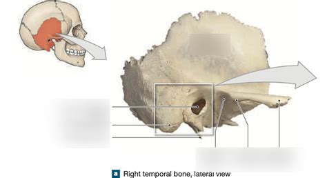 Right Temporal Bone Lateral View Diagram Quizlet