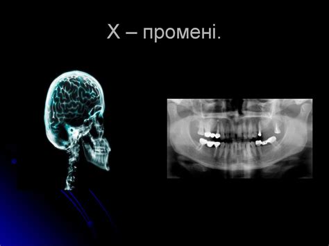 Шкала електромагнітних випромінювань. (11 клас) - online presentation