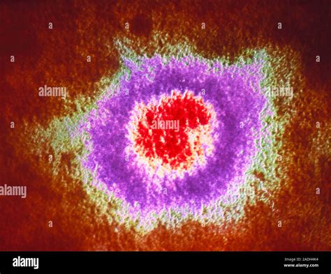 El Virus Del Herpes Simple Transmisión Color Micrografía De Electrones De Un Virus Herpes