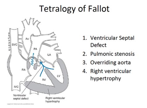 Peds Exam 2 Flashcards Quizlet