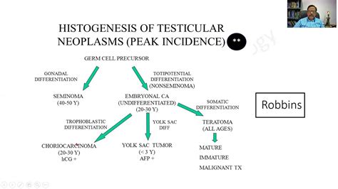 M G T Cryptorchidism Testicular Tumors Seminoma R A T S In