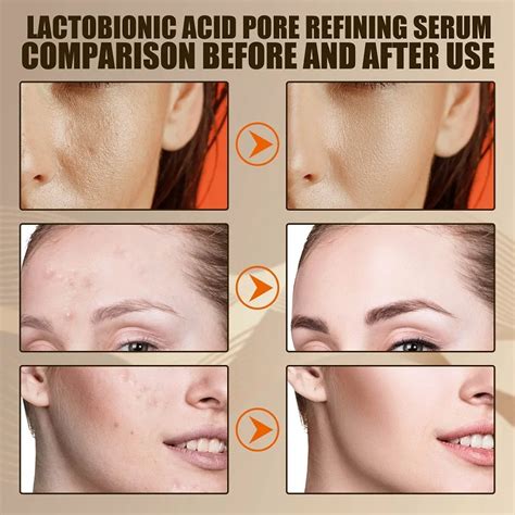 Lactobionic Acid Shrink Pores Facial Serum Firm Moisturizing Essence