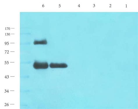 零基础学western Blot 知乎