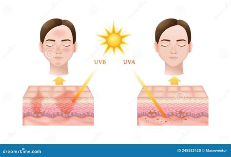 Uv Penetration Into The Layers Of The Skin Infographic Of Sunscreen