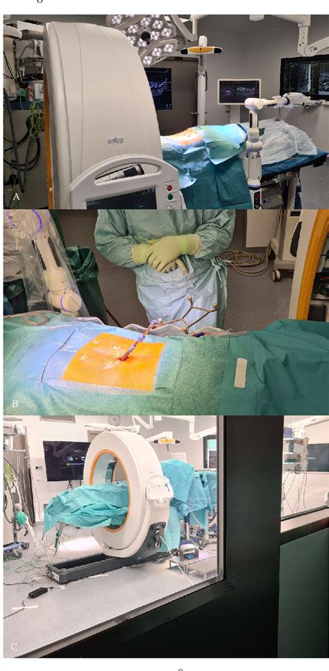 Figure 2 From Initial Intraoperative Experience With Robotic Assisted