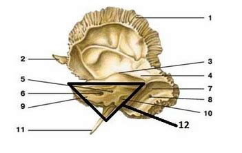 ANTH 5607 Cranial Vault Quiz Flashcards Quizlet