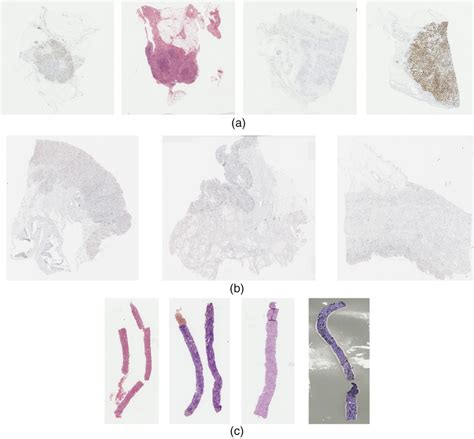 Examples Of Different Stains With Different Histopathological Sections