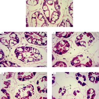 Hepatopancreas Tissue Structure Of L Vannamei With He Dye After