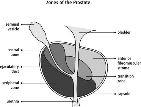 Prostate Zones Oncology Medical Physics