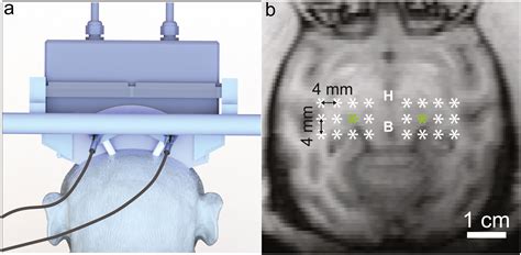 A Physiological Marker For Deep Brain Ultrasonic Neuromodulation