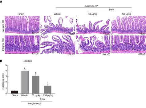 Irisin Attenuates Intestinal Injury Oxidative And Endoplasmic