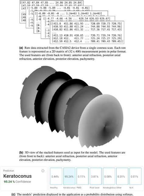 Automated Cornea Diagnosis Using Deep Convolutional Neural Networks