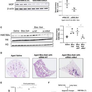 Inhibition Of Mof Improves The Resolution Of Lung Fibrosis In Aged