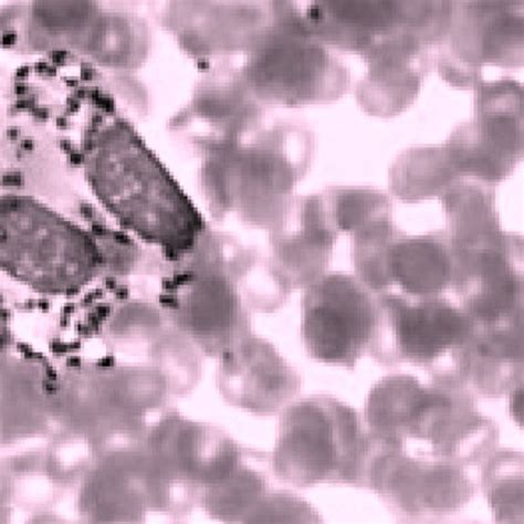 Localização Histórica Das áreas Endêmicas De Leishmaniose Mucosa Lm