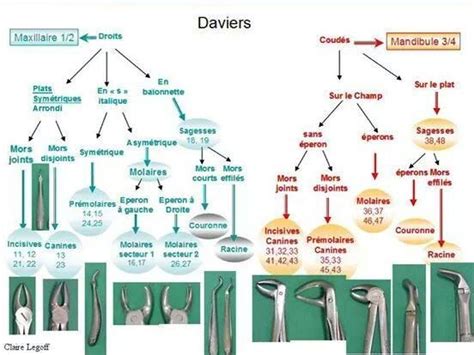 Daviers Et Extraction Dentaire Denti