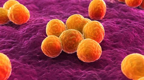 What Is Mrsa And Is It Contagious Mrsa Infection Symptoms And Treatment