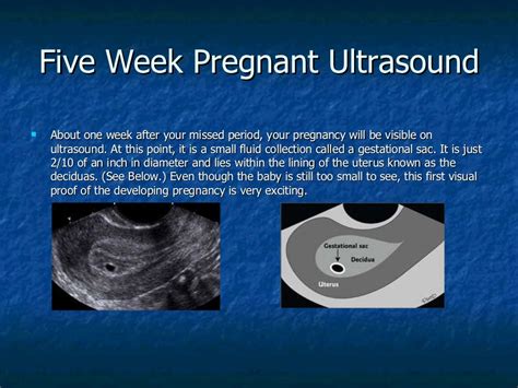 Ultrasound In Pregnancy