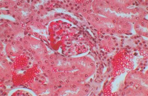 Glomerulus Convoluted Tubules And Blood Vessels Collection Of