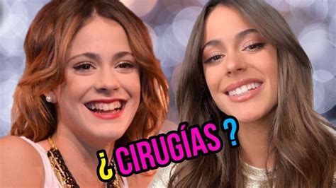 Tini Stoessel😲se A Hecho Cirugías También Entérate Sobre Su Relación