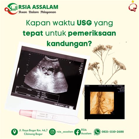 8 Kapan Waktu Yang Tepat Untuk Usg Kehamilan Hutomo