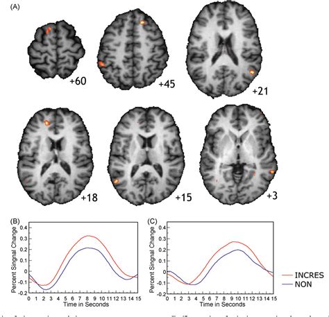 Figure 1 From Neural Substrates Of Incongruity Resolution And Nonsense Humor Semantic Scholar