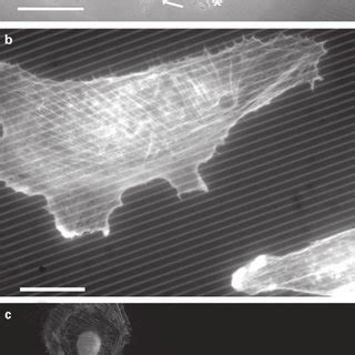 Effect Of Surface Composition On Osteopontin Expression In Calvarial