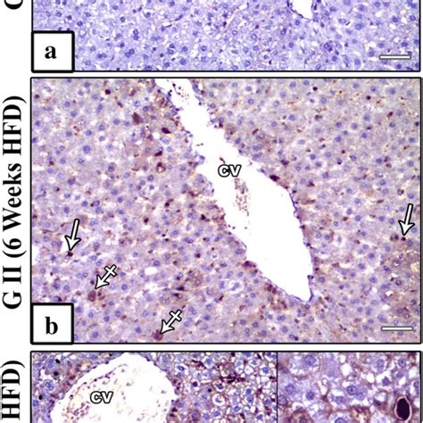 Photomicrographs Of Sudan III Stained Sections Of The Rat Liver Group