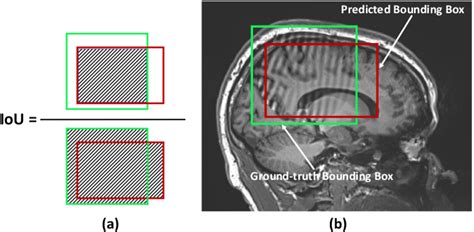 Figure From Localized Motion Artifact Reduction On Brain Mri Using