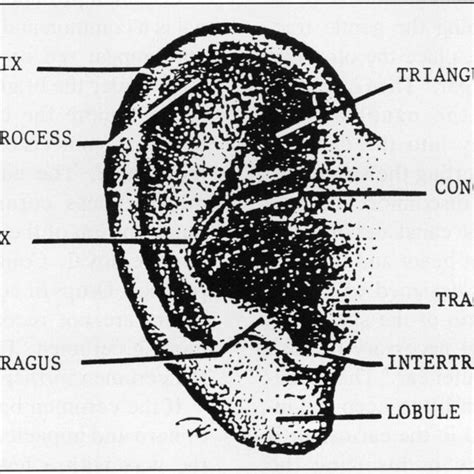 Presence Of Fluid And Air Bubbles Behind The Tympanic Membrane Download Scientific Diagram