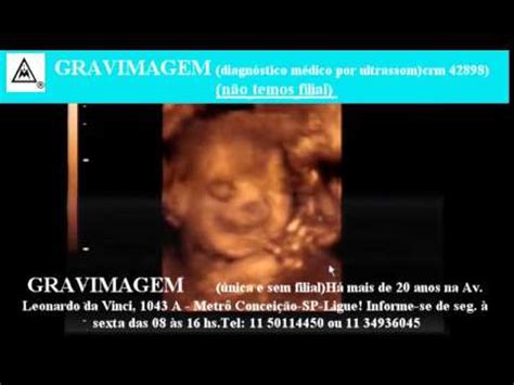 GRAVIMAGEM 17939 ultrassom morfológico 3d 4d em gravidez 24 semanas