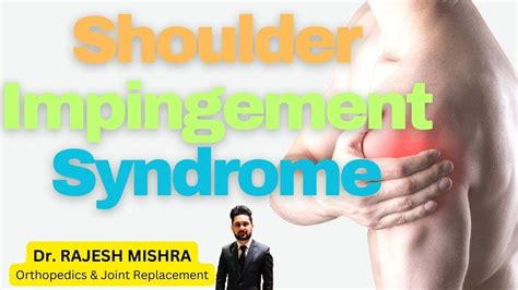 Shoulder Impingement Syndrome Causes Symptoms And Treatment