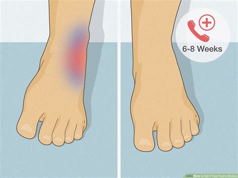 How To Tell If Your Foot Is Broken 12 Steps With 45 OFF