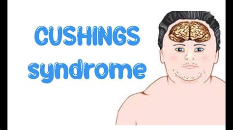 Cushings Syndrome All You Need To Know Clinical Features