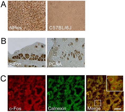 Expression And Subcellular Localization Of C Fos In Cns And Pns Tumors Download Scientific