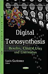 Digital Tomosynthesis: Benefits, Clinical Uses and Limitations: 9781634851329: Medicine & Health ...