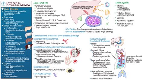 USMLE COMLEX Step 2 Liver Pathology Overview Cirrhosis PHT