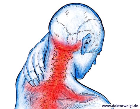 Dokor Weigl Erkl Rt Das Hws Syndrom Nackenverspannung