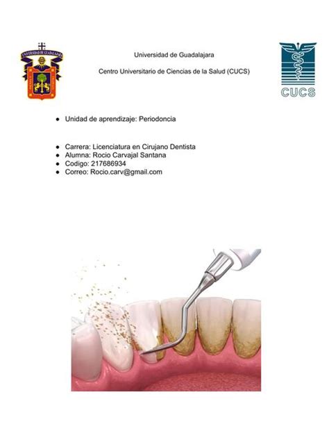 Placa Biofilm Areli Quintero Udocz