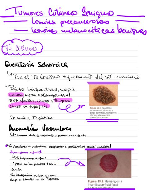 SOLUTION Tumores Cutaneos Benignos Studypool